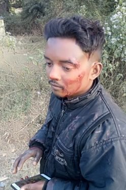 जगन्नाथपुर : मोंगरा में कार से टकरायी तेज रफ्तार बाइक, युवक घायल, जमशेदपुर जा रही थी कार