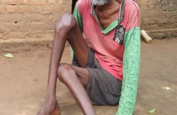 Chakuliya-Helplessness : आमाभूला सबर टोला निवासी बांका सबर इलाज के अभाव में जमीन पर घसीट कर चलने को मजबूर
