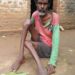 Chakuliya-Helplessness : आमाभूला सबर टोला निवासी बांका सबर इलाज के अभाव में जमीन पर घसीट कर चलने को मजबूर