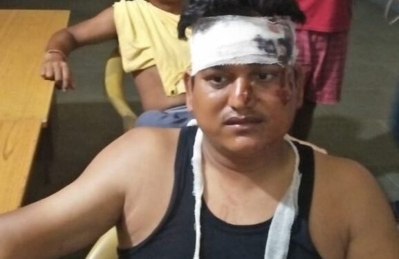 चाकुलिया : दो पक्षों में मारपीट, दो भाई जख्मी, पिता और पुत्र के खिलाफ थाना में की शिकायत