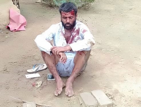 Saraikela : पत्नी के साथ आपत्तिजनक स्थिति में देख आगबबूला हुआ पति, प्रेमी की जमकर की पिटाई, गंभीर Saraikela : पत्नी के साथ आपत्तिजनक स्थिति में देख आगबबूला हुआ पति, प्रेमी की जमकर की पिटाई, गंभीर