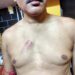 Jamshedpur Crime : भुइयांडीह निवासी के घर में घुस कर पड़ोसियों ने की मारपीट, डंडे व रड से मार कर किया जख्मी, थाने में शिकायत, देखिये घटना का फुटेज