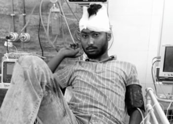 Adityapur firing – आदित्यपुर में गोलीबारी से सनसनी, युवक के सिर में लगी गोली