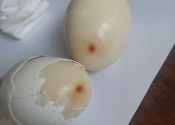 tata steel canteen synthetic egg : टाटा स्टील के कैंटीन में ”सिंथेटिक अंडा” परोसने से खलबली, मची रही दिन भर अफरा तफरी