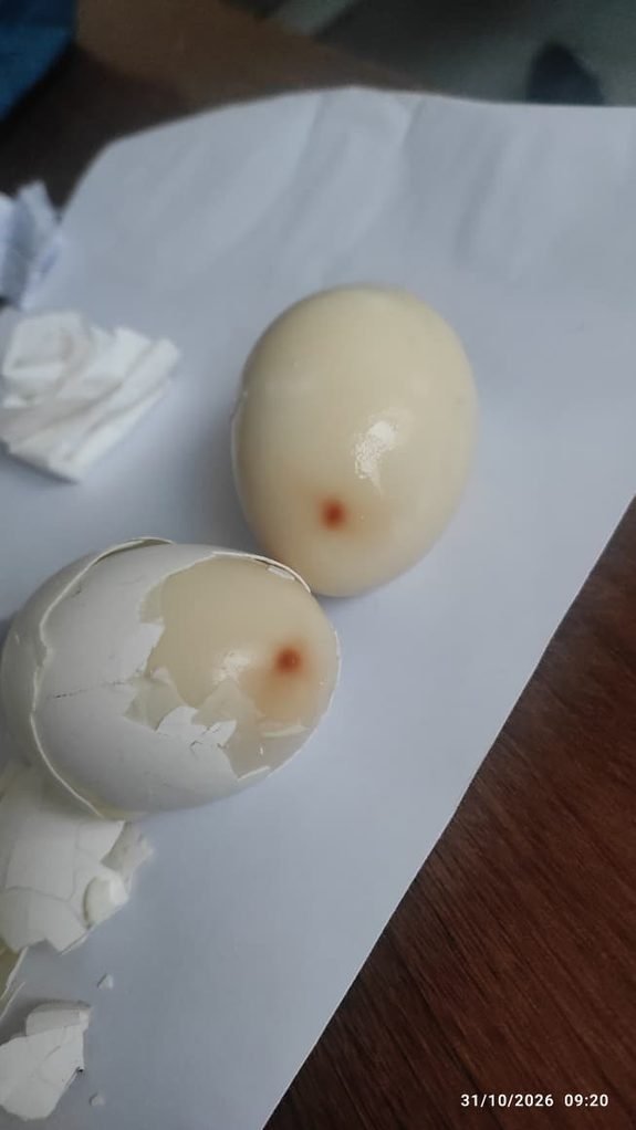 tata steel canteen synthetic egg : टाटा स्टील के कैंटीन में ”सिंथेटिक अंडा” परोसने से खलबली, मची रही दिन भर अफरा तफरी tata steel canteen synthetic egg : टाटा स्टील के कैंटीन में ”सिंथेटिक अंडा” परोसने से खलबली, मची रही दिन भर अफरा तफरी