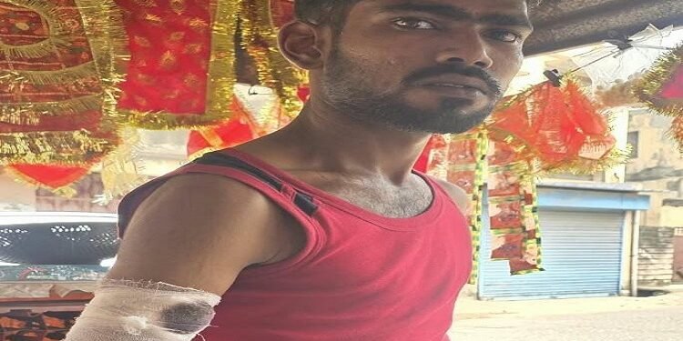 Jamshedpur clash : गोलपहाड़ी में ग्राहक को लेकर दो दुकानदारों में विवाद के बाद एक दुकानदार पर हमला, दूसरे दुकानवालों ने नारियल छीलनेवाले हुक से मारकर किया घायल Jamshedpur clash : गोलपहाड़ी में ग्राहक को लेकर दो दुकानदारों में विवाद के बाद एक दुकानदार पर हमला, दूसरे दुकानवालों ने नारियल छीलनेवाले हुक से मारकर किया घायल